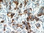 CEA Antibody in Immunohistochemistry (Paraffin) (IHC (P))