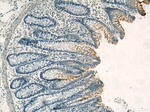 CEA Antibody in Immunohistochemistry (Paraffin) (IHC (P))