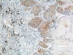 CEA Antibody in Immunohistochemistry (Paraffin) (IHC (P))