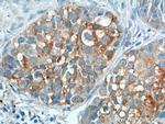 CEA Antibody in Immunohistochemistry (Paraffin) (IHC (P))