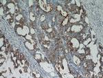 CEA Antibody in Immunohistochemistry (Paraffin) (IHC (P))