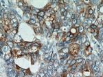 CEA Antibody in Immunohistochemistry (Paraffin) (IHC (P))