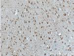 SOX10 Antibody in Immunohistochemistry (Paraffin) (IHC (P))