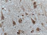 SOX10 Antibody in Immunohistochemistry (Paraffin) (IHC (P))