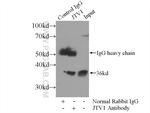 JTV1 Antibody in Immunoprecipitation (IP)