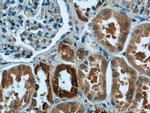 JTV1 Antibody in Immunohistochemistry (Paraffin) (IHC (P))