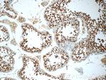 JTV1 Antibody in Immunohistochemistry (Paraffin) (IHC (P))