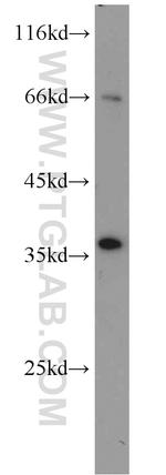 JTV1 Antibody in Western Blot (WB)