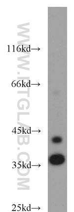 JTV1 Antibody in Western Blot (WB)