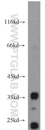 JTV1 Antibody in Western Blot (WB)