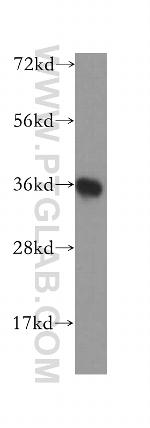 JTV1 Antibody in Western Blot (WB)