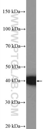 JTV1 Antibody in Western Blot (WB)