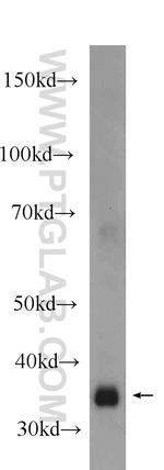 JTV1 Antibody in Western Blot (WB)