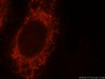 YY1AP1 Antibody in Immunocytochemistry (ICC/IF)