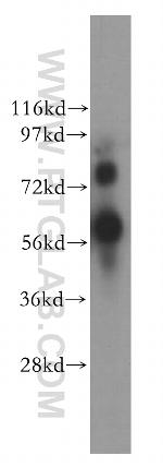 YY1AP1 Antibody in Western Blot (WB)