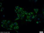 MAX Antibody in Immunocytochemistry (ICC/IF)