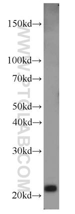 MAX Antibody in Western Blot (WB)