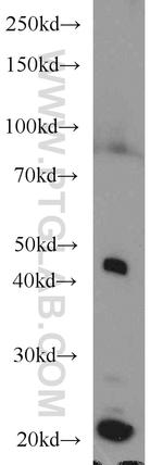 MAX Antibody in Western Blot (WB)