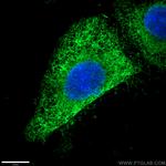 Calnexin Antibody in Immunocytochemistry (ICC/IF)