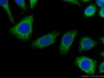 Calnexin Antibody in Immunocytochemistry (ICC/IF)