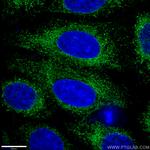 Calnexin Antibody in Immunocytochemistry (ICC/IF)