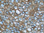 Calnexin Antibody in Immunohistochemistry (Paraffin) (IHC (P))