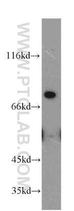 MFI2 Antibody in Western Blot (WB)