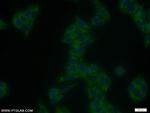 SMAD1 Antibody in Immunocytochemistry (ICC/IF)