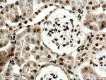 CDK5 Antibody in Immunohistochemistry (Paraffin) (IHC (P))