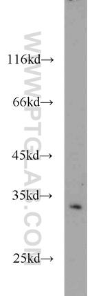 CDK5 Antibody in Western Blot (WB)