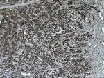 BAD Antibody in Immunohistochemistry (Paraffin) (IHC (P))