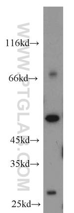 Caspase 2/p18 Antibody in Western Blot (WB)