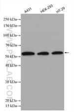 P53 Antibody in Western Blot (WB)