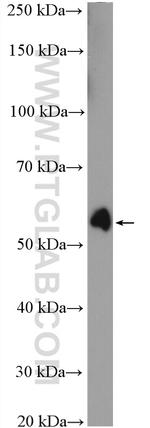 P53 Antibody in Western Blot (WB)