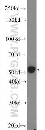 P53 Antibody in Western Blot (WB)