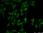 NOP2 Antibody in Immunocytochemistry (ICC/IF)