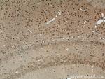 NOP2 Antibody in Immunohistochemistry (Paraffin) (IHC (P))