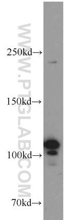 NOP2 Antibody in Western Blot (WB)