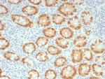 CDX2/Caudal Type Homeobox 2 (GI Epithelial Marker) Antibody in Immunohistochemistry (Paraffin) (IHC (P))