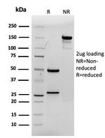 CDX2/Caudal Type Homeobox 2 Antibody in SDS-PAGE (SDS-PAGE)