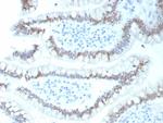 CDX2/Caudal Type Homeobox 2 (GI Epithelial Marker) Antibody in Immunohistochemistry (Paraffin) (IHC (P))