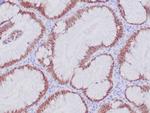 CDX2/Caudal Type Homeobox 2 Antibody in Immunohistochemistry (Paraffin) (IHC (P))