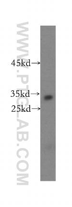 Connexin-32 Antibody in Western Blot (WB)