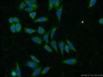 CLTB Antibody in Immunocytochemistry (ICC/IF)