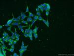 CLTB Antibody in Immunocytochemistry (ICC/IF)