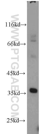 CLTB Antibody in Western Blot (WB)