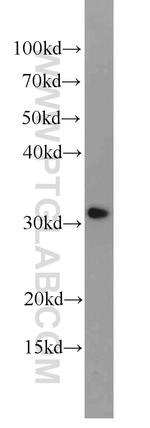 CLTB Antibody in Western Blot (WB)