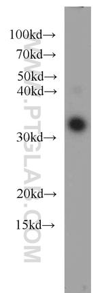 CLTB Antibody in Western Blot (WB)