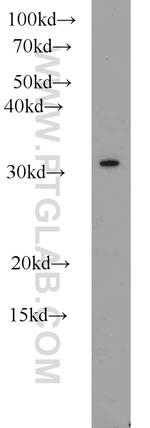 CLTB Antibody in Western Blot (WB)