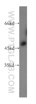 EIF4A3 Antibody in Western Blot (WB)